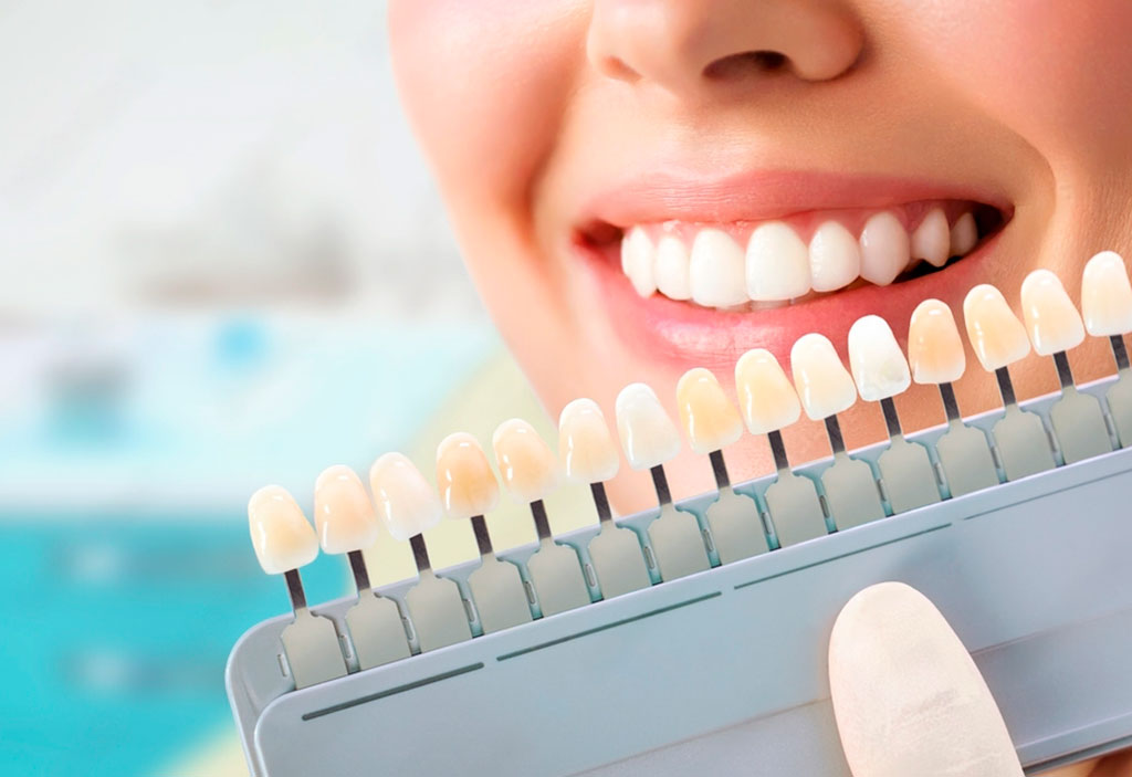 Estética Dental Majadahonda tonos dentales