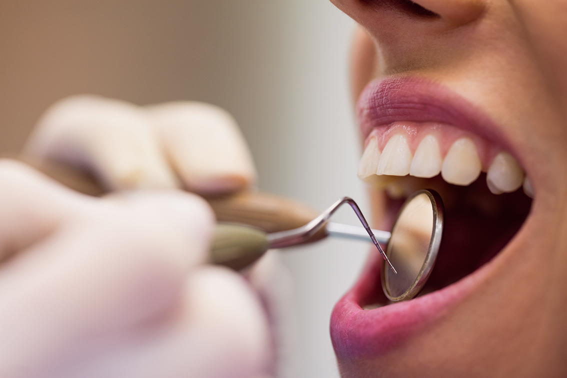 por que es importante acudir regularmente dentista